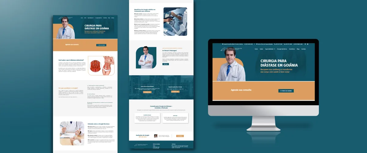 Mockup de monitor com o site do Dr. Renan R. Marangoni sobre cirurgia de diástase abdominal em Goiânia