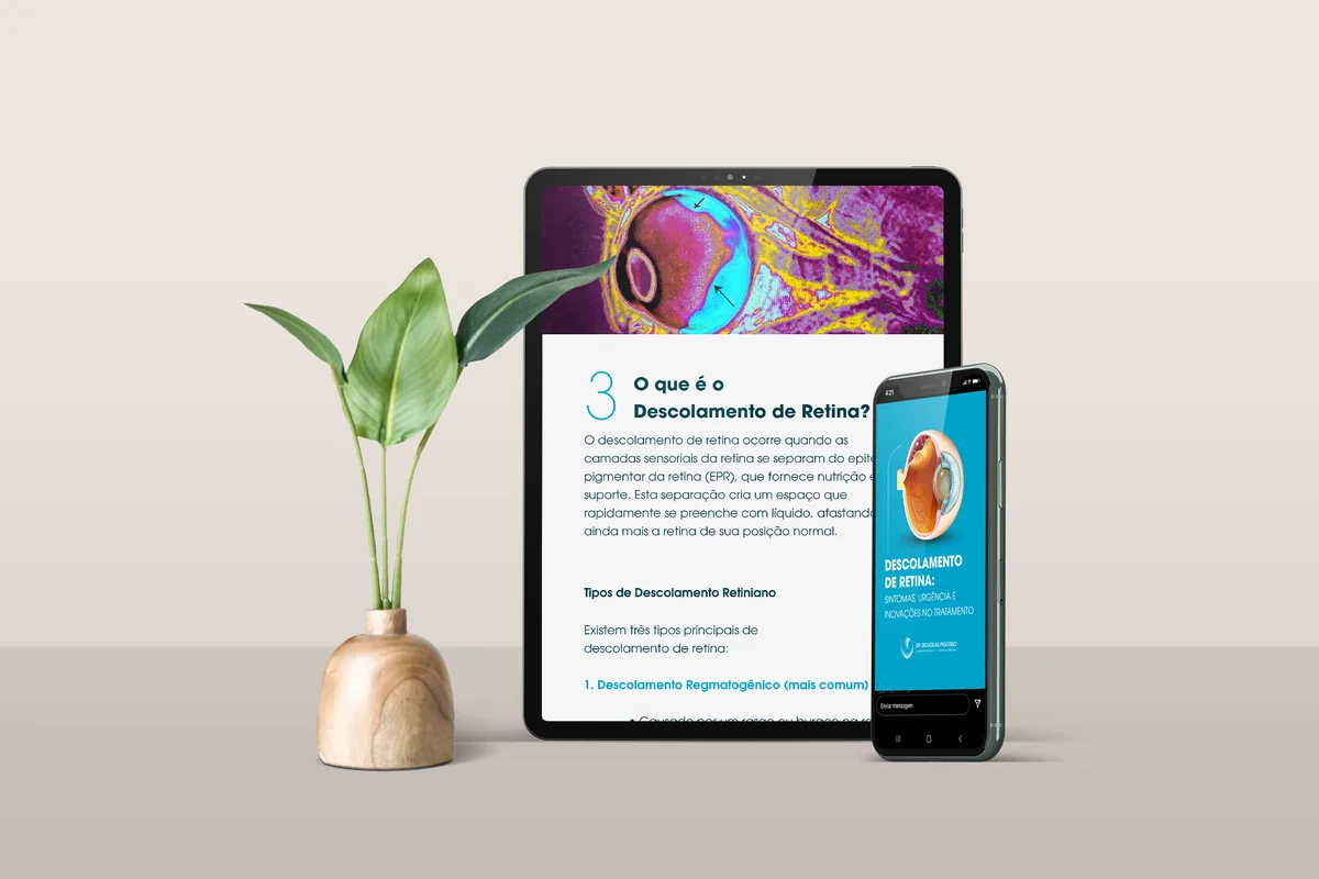 Tablet e celular com o e-book do Dr. Douglas Pigosso sobre descolamento de retina