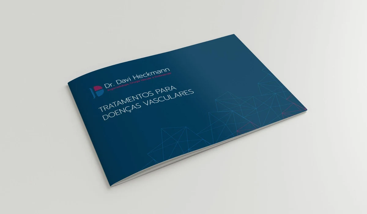 Mockup de e-book do Dr. Davi Heckmann sobre tratamentos para doenças vasculares, em Brasília