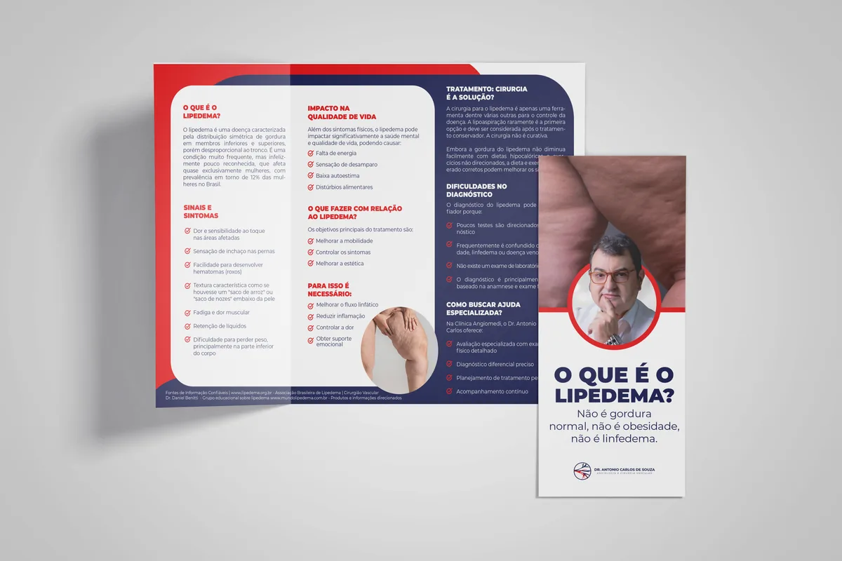 Folder educativo do Dr. Antonio Carlos de Souza sobre lipedema, angiologia e cirurgia vascular